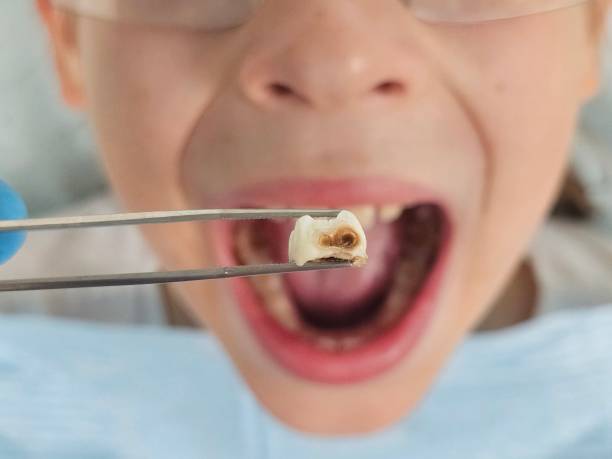 Best Mobile Emergency Dentist in Ackerman, MS